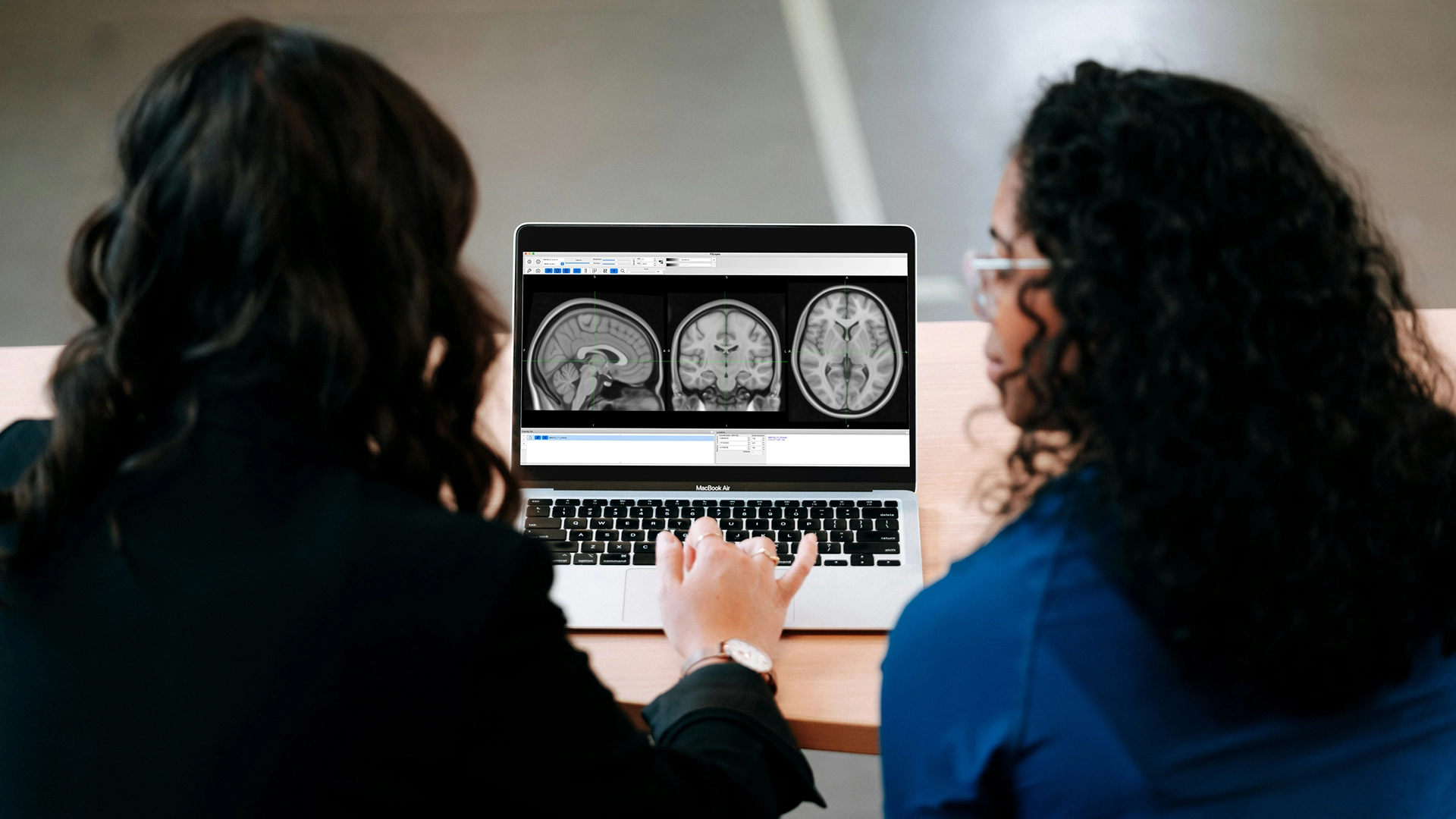 Novo Sistema de IA do MIT Torna a Segmentação de Imagens Mais Rápida e Fácil